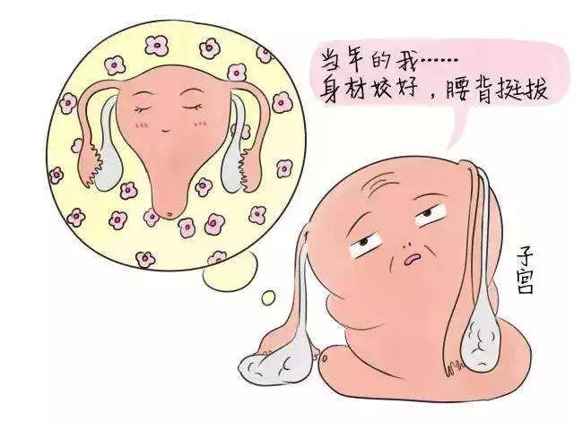 女性子宫粘连,治疗方法