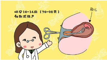 引产32天肚子痛有血是来例假吗?